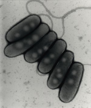 Legionella klimatizace